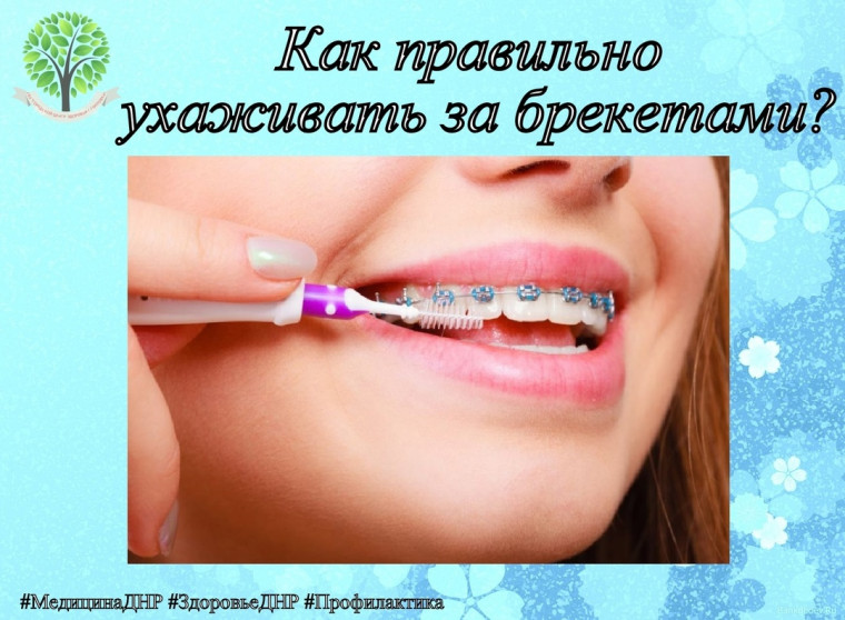 Как правильно ухаживать за брекетами?. Как правильно ухаживать за брекетами?.